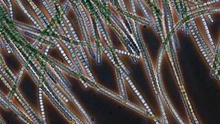 Viellzelliges Cyanobakterium (Bild: Universität Zürich)