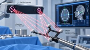 Schema: Passive Reflektormarker werfen das Infrarotlicht der Tracking-Kamera zurück; daraus ermittelt das System Lage und Ausrichtung des Instruments. Fehler der Beschichtung stören diese Erkennung. (Bild: KI-generierte schematische Illustration nach Angaben von Medtronic und Northern Digital Inc. (NDI))