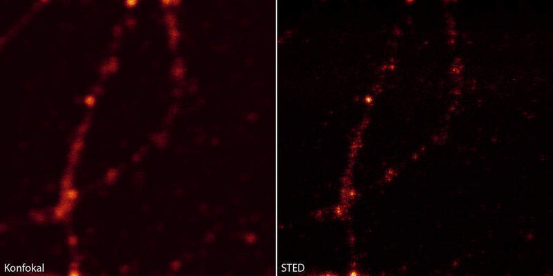 Die Bilder zeigen verschiedene Bereiche in Axonen von Neuronen in Zellkultur. Die Zellen stammen aus dem Hippocampus der Ratte (Rattus norvegicus). Das synaptische Protein Synaptotagmin 1 wurde mit einem primären monoklonalen Maus-Antikörper und mit einem sekundären Antikörper markiert, der den Fluoreszenzfarbstoff trägt (Atto 647N). Im STED-Modus sind die synaptischen Vesikel als einzelne Punkte deutlich zu erkennen (rechts), im Gegensatz zum Konfokalmodus (links). (Archiv: Vogel Business Media)