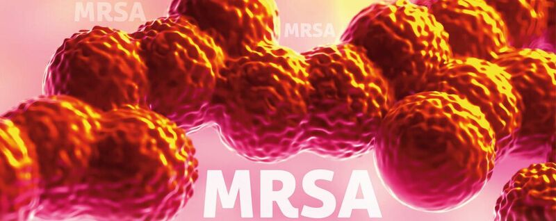 Abb.1:  Antibiotikaresistente Bakterien wie der Methicillin-resistente Staphylococcus aureus (MRSA) fordern weltweit Gesundheitssysteme heraus.