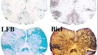 Multiple Sklerose ist eine komplexe Krankheit des Nervensystems. Forscher erhielten jetzt deutlich bessere Einblicke in ihre Entstehung und Abläufe.  (Bild: Max-Planck-Institut für Neurobiologie)