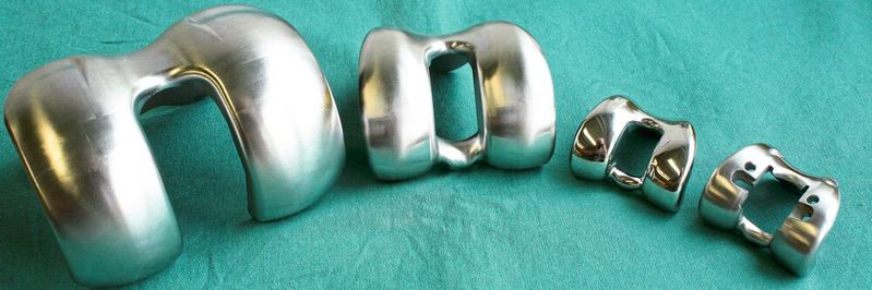 Knieimplantate von groß bis klein:
Mit Hypermill sind alle Größen von gedruckten Implantaten sicher nachzubearbeiten. Knieimplantate von groß bis klein:
Mit Hypermill sind alle Größen von gedruckten Implantaten sicher nachzubearbeiten.