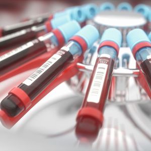 In Bio- und Life-Science-Laboren gehört die Zentrifuge zum Basisequipment (Symbolbild).(Bild:  © ktsdesign - stock.adobe.com)