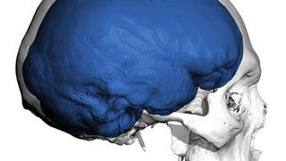 Aufnahme des Gehirns eines erwachsenen Menschen.  (Bild: Max-Planck-Institut für evolutionäre Anthropologie / Philipp Gunz)