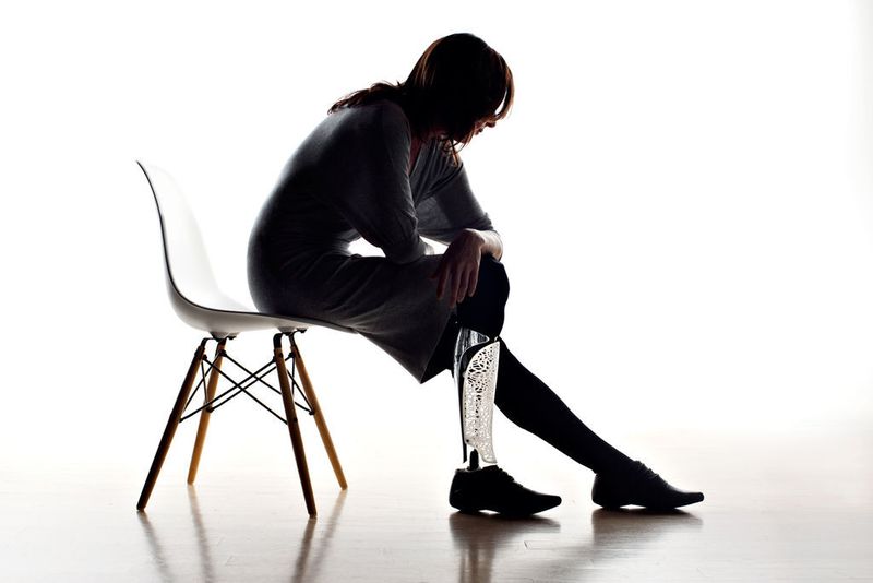 Beinprothese passend zum Outfit  (Bild: 3D Systems)