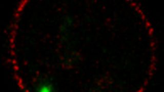 Erbinformation der HI-Viren (grün) am Rande des Zellkerns in der Nähe der Kernporen (rot) einer infizierten Zelle des Immunsystems (CD4 T-Zelle). (Bild: Universitätsklinikum Heidelberg)