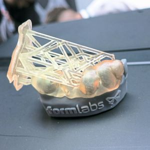 Und so sieht die Zahnschiene von Nahem aus.(Bild:  Schäfer / Devicemed)