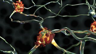 Verdächtige Eiweissbausteine und -fibrillen sammeln sich bei Demenzerkrankungen an Nervenzellen an.  (Bild: Empa)