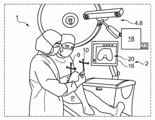 Ein Endoprothesen-Assistenzsystem und Assistenzverfahren(Bild:  B. Braun New Ventures GmbH/DPMA)