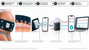 So soll M•care arbeiten: Das Bauchband erfasst ein Signalgemisch, erst der Server trennt Herzsignale von Kind und Mutter sowie Wehen. (Bild: KI-generierte Illustration nach Studienprotokoll MH-001 / Redaktion Devicemed)