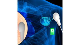 The team has developed a way to remotely charge a battery, such as that in a pacemaker, using a soft, biocompatible material that absorbs sound waves passed through the body. (Kaust)