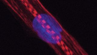 Humane Muskelzelle. Bei Menschen, die Statine nehmen, war u.a. die Produktion von Myosinen gestört. Diese Proteine sind im Bild rot angefärbt, der Zellkern blau. Die Querstreifen zeigen, dass die Zelle sich in eine reife Muskelfaser entwickelt. (Andreas Marg, MDC)