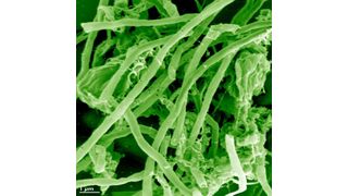 Electron microscope photograph of the Electrochaea archaea strain, a variant of Methanothermobacter thermautotrophicus. (Prof. Andras Klingl)