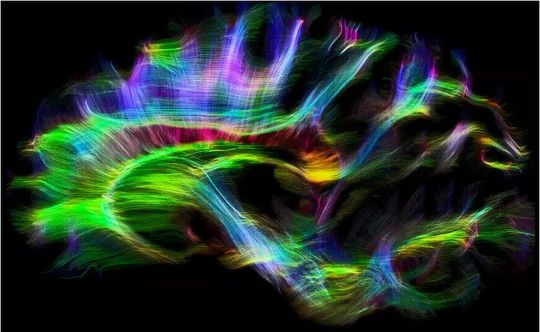 Nervenfasern im Gehirn eines Schimpansen(Bild:  © MPI CBS)