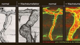 Darstellung natürlich wachsender lebender Arterien und fluoreszenzmikroskopische Darstellung des Blutflusses und des endothelialen Aktin Zytoskeletts. (Bild: ZOO, KIT)