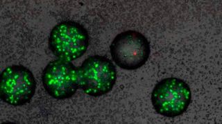 Mikro-Gel-Kügelchen mit grün fluoreszierenden Sensor-Bakterien. In einem der Kügelchen (Mitte) wurden die Sensor-Bakterien von einem Wirkstoff abgetötet (mikroskopische Aufnahme).  (ETH Zürich / Steven Schmitt und Helena Shomar)