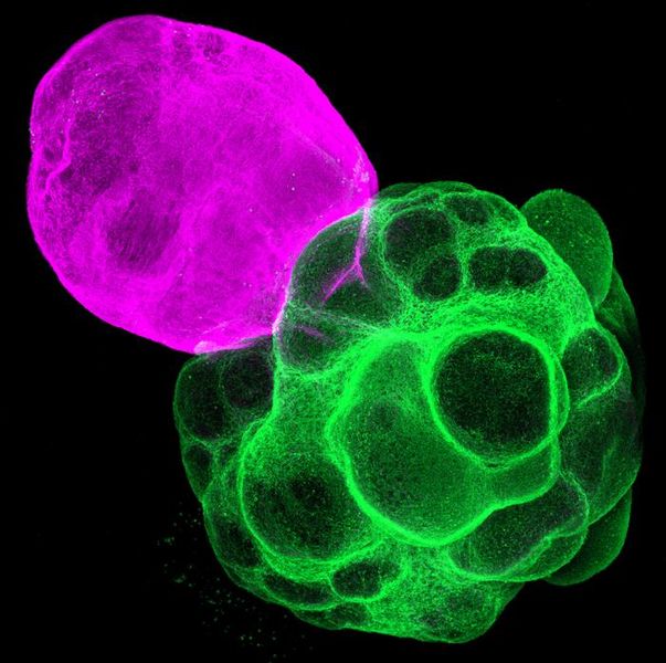  Hirnfusion  Eine japanische Forschungsgruppe hat es geschafft, menschliche neuronale Schaltkreise in vitro nachzubilden, indem sie Miniaturorgane, sogenannte Assembloide, verwendet hat. Diese Organe stammen aus induzierten pluripotenten Stammzellen (iPS-Zellen). Bei dieser Forschung wurde festgestellt, dass der Thalamus eine wichtige Rolle bei der Bildung von neuronalen Schaltkreisen im menschlichen Kortex spielt.  Das Forschungsteam kombinierte Organoide des Kortex und des Thalamus, um deren Interaktionen zu untersuchen. Dabei fanden sie heraus, dass Nervenverbindungen zwischen diesen Bereichen ähnlich funktionieren, wie im menschlichen Gehirn und dass diese Interaktionen das Wachstum und die Reifung des Kortex unterstützen.  Außerdem analysierten sie die neuronale Aktivität in verschiedenen Neuronen des Kortex. Ihre Ergebnisse legen nahe, dass Eingaben vom Thalamus die Bildung von synchronisierten Netzwerken fördern. Diese Forschung könnte helfen, die Grundlagen neurologischer und psychiatrischer Störungen besser zu verstehen und neue Therapien zu entwickeln. Die Studie ist besonders wichtig für das Verständnis von Störungen wie Autismus, bei denen die neuronalen Verbindungen im Kortex gestört sind.   Bild: Axone im Thalamus (pink) erstrecken sich in Richtung des Kortex, während jene im Kortex (grün) in Richtung des Thalamus wachsen, 14 Tage nach der Fusion.    Hier gehts zur OriginalmeldungWissenschaftsbild des Tages vom 18.12.2025  (Bild: Fumitaka Osakada )