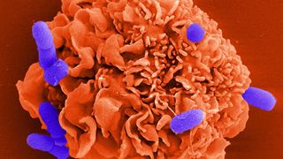 Mastzelle mit Salmonellen-Bakterien.  (Bild: Manfred Rohde, HZI)