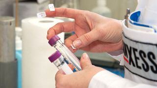 Ab sofort bezieht Lanxess biobasierte Rohstoffe aus pflanzlichen Ölen, um daraus eine neue Serie von nachhaltigen Konservierungsmitteln herzustellen. (Bild: Ulla Anne Giesen)