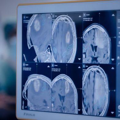 Medizinische Bildgebung unterstützt die Planung moderner Strahlentherapien. Föderierte KI-Ansätze soll dabei neue Möglichkeiten eröffnen.  (Bild: © www.kit.edu/ Magali Hauser, KIT)