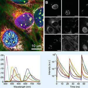 Abb. 1: Neun verschiedene Zellstrukturen wurden fluoreszenzmarkiert und mithilfe von sFLIM abgebildet (A). Einzelne Strukturen (B) konnten dank individueller Pattern der fluoreszenzmarkierten Sonden (C) detektiert werden.