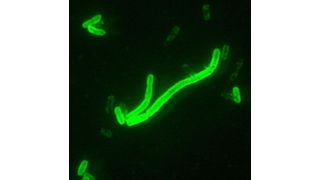 Yersinia pestis, Direct Fluorescent Antibody Stain (DFA), 200x Vergrößerung (Quelle: en.wikipedia.org) (Archiv: Vogel Business Media)