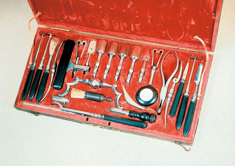 Besteckkasten mit Instrumenten zur Schädelöffnung aus dem 17./18. Jahrhundert. Bild: Aesculap (Archiv: Vogel Business Media)