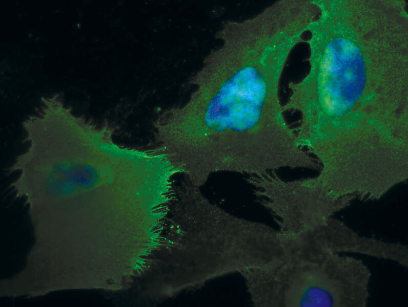 Abb.4: Erfolgreich transfizierte humane embryonale Nierenzellen 293 exprimieren ein Protein mit grüner Fluoreszenz. (Archiv: Vogel Business Media)