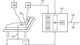 Ein Medizinsystem zum Bestimmen eines Herzzeitvolumen-abhängigen Parameters. (Bild: DPMA)