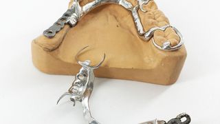 Among other 3D printed components the removable partials are polished with the dry electropolishing system.  (Teamziereis GmbH)