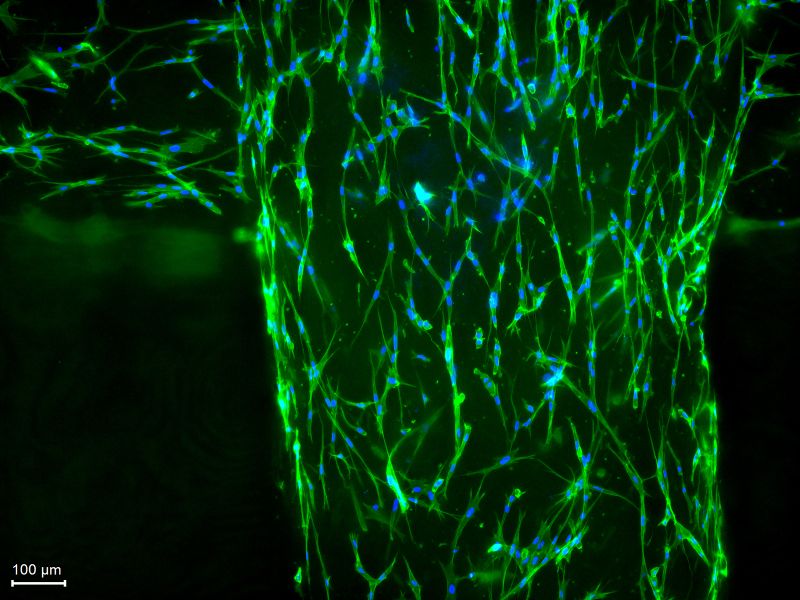 In the PhysioINK project, Fraunhofer researchers are developing bio-printing inks from the most common tissue proteins. Under the microscope, the living tissue cells (fibroblasts) are visible in the printed lattice structure: blue represents the cell nucleus, and green represents the cytoskeleton.(Source:  Tobias Weigel/Fraunhofer ISC)