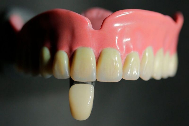 Monolithische Zahnprothese aus dem 3D-Drucker: Mit einem biomimetischen Multi-Material-Workflow zeigt das Fraunhofer IGD, wie natürlich wirkende Ästhetik durch digital eingebettete Schichten aus Schmelz, Dentin und Zahnwurzel erzielt wird. (Bild: Fraunhofer IGD)