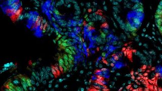 Schnitt durch den Darm: Oberste Zellschicht der Darmwand, sichtbar gemacht durch verschiedene fluoreszierende Proteine (Mausmodell). ((c) Diefenbach/Charité)