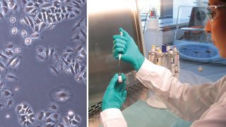 Gebärmutterhalskarzinomzellen lassen sich mit in Nanopartikel verkapseltem Krebs-Wirkstoff effektiv und zielgenau abtöten (links). Hier wird der Wirkstoff Doxorubicin vorbereitet – ein in der Chemotherapie häufig verwendetes Medikament (rechts). (Bild: Fraunhofer IAP)