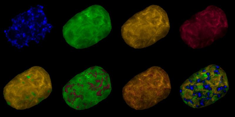 Bilder der fluoreszierenden in-situ Hybridisierung einer eingefärbten Achromatium oxaliferum Zelle. (Mina Bizic-Ionescu / IGB )