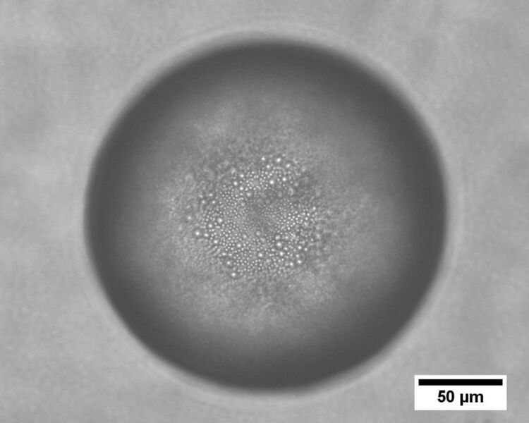 Abb. 4: Emulsion Öl in Wasser - große und kleine Partikel gemischt ( Gruppe Vermant, ETH Zürich)