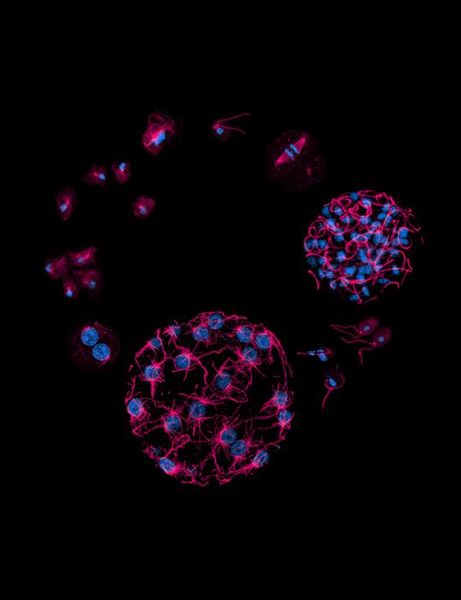   Neue DNA-Markierungen Tiere, Pflanzen und Menschen markieren ihre DNA oft an der Base Cytosin. Das nennt man Methylierung und beeinflusst z.B. Krankheiten und das Älterwerden.  Die neue Studie zeigt: Manche Einzeller markieren nicht nur Cytosin, sondern auch Adenin. Damit steuern sie Gene an und aus – teils sogar komplexer als mehrzellige Organismen. Bei vielen Einzellern ist die Adenin-Markierung wichtig fürs Überleben. Da zahlreiche Krankheitserreger einzellig sind, könnte das gezielte Angreifen der Adenin-Methylierung eine neue Strategie zur Bekämpfung von Parasiten darstellen. Obwohl Medikamente erst entwickelt und getestet werden müssen, eröffnet dies neue Wege der Wirkstoffforschung, etwa gegen Protisten wie Trichomonas, Blastocystis oder die sogenannte „hirnfressende“ Amöbe.  Das Bild zeigt die Vielfalt einzelliger Eukaryoten, deren Zellkern (blau) und mikrotubuläres Zytoskelett (magenta) angefärbt sind, wobei diese Organismen untereinander so entfernt verwandt sind, wie sie es auch mit uns oder mit Pflanzen sind.  Hier gehts zur OriginalmeldungWissenschaftsbild des Tages vom 25.11.2025  (Bild: Omaya Dudin, University of Geneva)