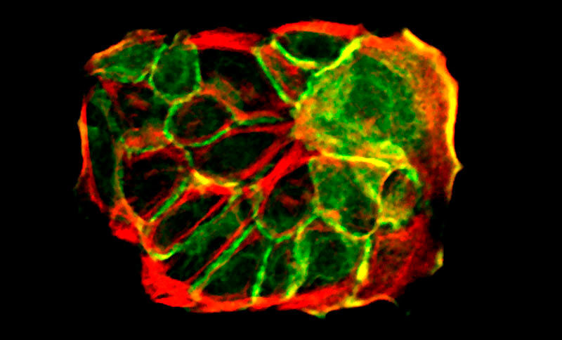 Hautzellen in der Petrischale (grün: Zellskelett, rot: Zell-Zell-Verbindungsprotein).  (© MPI f. Biologie des Alterns)