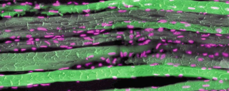 Sport lässt die Muskeln wachsen, aber die Frage, was auf molekularer Ebene passiert, ist bislang nicht eindeutig geklärt. Wissenschaftler aus Basel haben nun die Rolle des „Wachstums-Proteins“ Myc neu untersucht. Das Bild zeigt einen Gewebeschnitt vielkerniger Muskelfasern (grün, Zellkerne in pink). (Bild:  DOI: 10.1038/s41467-025-58542-7)