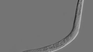 Das analoge Original: der Fadenwurm C.elegans (C.elegans / Zeynep F. Altun / CC BY-SA 2.5)