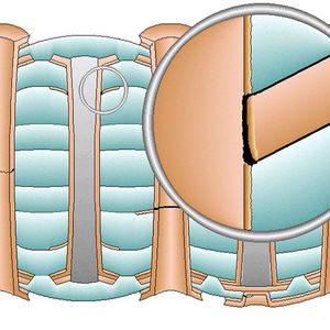 Bei einer Multilayer-Leiterplatte trifft die Kupferhülse der Bohrung auf die Kupferflächen der einzelnen Innenlagen. An diesen Übergängen entstehen kleine Anschlussstellen. Durch wiederholtes Erwärmen und Abkühlen dehnt sich das Basismaterial in Dickenrichtung stärker aus als das Kupfer. Dadurch wirken Zugkräfte auf diese Verbindungen. Ist eine Stelle zu schwach, löst sich die Kupferhülse von der Innenlage. (Bild: Polar Instruments)