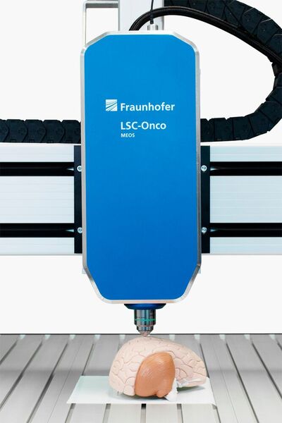 The laser scanning microscope of the LSC-Onco project is so small and compact thanks to the use of MEMS technology that it can also be used directly on the patient in the operating room. (Source: Fraunhofer IPMS)