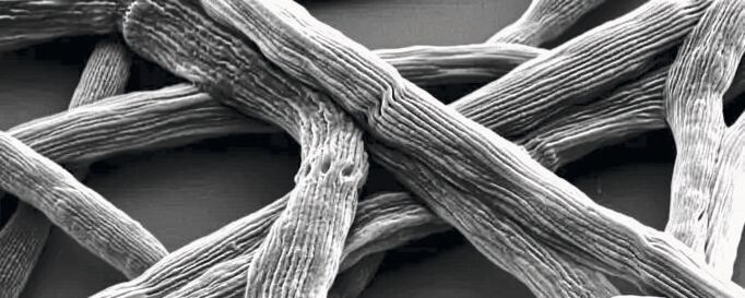 Das Kabelbakterium Candidatus Electronema, hier 10.000fach vergrößert, war 2024 „Mikrobe des Jahres“. Nun steht es im Fokus eines Forschungsprojekts der Mülheimer Max-Planck-Institute. (Bild:  Pia B. Jensen, Aarhus  / CC BY )