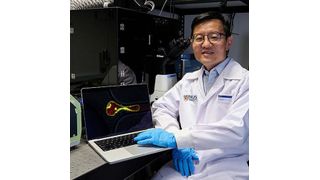 Prof Lim Chwee Teck showing an image of a ‘mechano-resilient’ cancer cell undergoing extensive deformation as the cell is squeezed through a narrow channel. (Source: National University of Singapore)