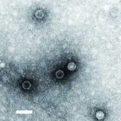 Polioimpfstoff (1955)    Ein Polioimpfstoff ist ein Impfstoff zur Prophylaxe einer durch das Poliovirus hervorgerufenen Poliomyelitis. Zwei grundlegend verschiedene Impfstoffe stehen zur Verfügung: seit 1955 eine von Jonas Salk entwickelte inaktivierte Polio-Vakzine, abgekürzt IPV, sowie seit 1961 eine von Albert Sabin entwickelte orale Polio-Vakzine, abgekürzt OPV. Mit dem Einsatz beider Impfstoffe, die jeweils spezifische Vor- und Nachteile haben, wurde die Zahl der Poliomyelitis-Erkrankungen seit den 1950er Jahren weltweit drastisch reduziert. (Archiv: Vogel Business Media)
