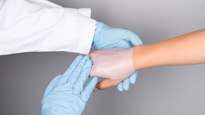 Schmerzlinderung und Unterstützung bei der Heilung – Wundauflagen können künftig Hydrogele ersetzen.(Bild:  Evonik Industries, Jenacell)