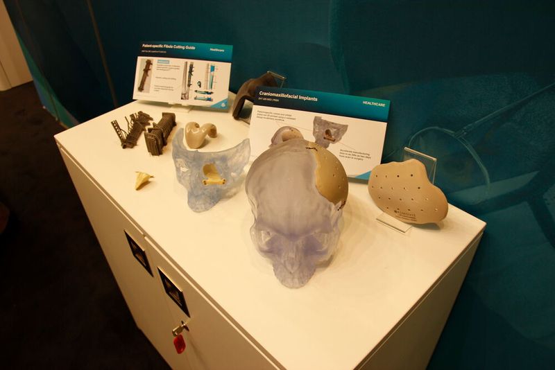 ... darunter verschiedene Implantate ... (Bild: Breunig – VCG)