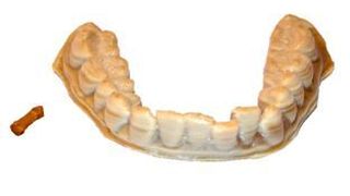 “PEEKmed“ Filament der Klasse IIa ist einsetzbar für verschiedene medizinische, dentale und chirurgische Anwendungen. (Bild: Indmatec)