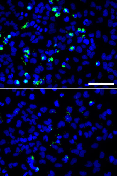 Salmonellen (grün) in einer Kultur von menschlichen Immunzellen (blau). Durch die Aktivität einer speziellen mikro-RNA konnten die Bakterien in der Kultur unten die Zellen nicht infizieren. (Bilder:Ana Eulalio)