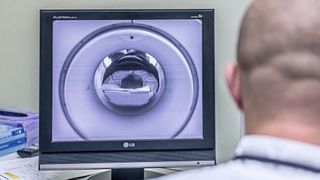 Philips arbeitet auf dem Gebiet der diagnostischen Bildgebung mit dem schwedischen Software-Hersteller Synthetic MR zusammen. Ziel ist eine präzisere und effizientere Diagnose von Nervenkrankheiten. (Bild: frei lizenziert)